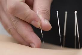 ACUPUNCTURE & HEALING TECHNIQUES